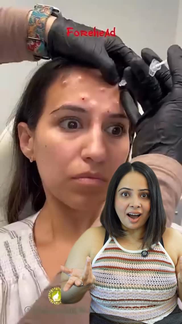 Alia Bhatt’s look has taken over the internet and I’m loving it so much..🎀
What a flawless look WOW😍

But if you don’t want to have needles pricked in your face but you want the same effect then you can try Dr. Sheth’s A