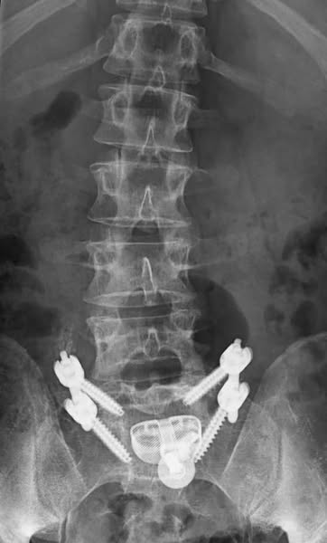 Here's what no one told you about your back pain