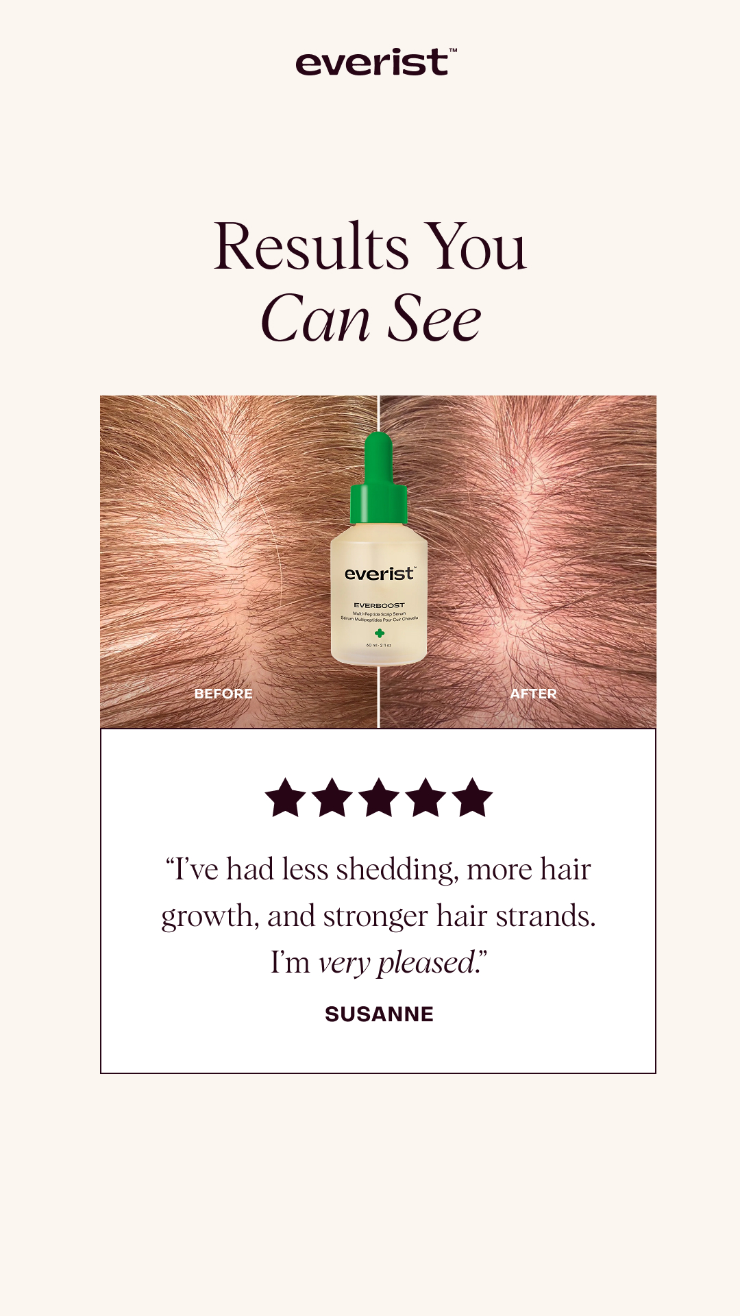 Transform brittle, dry, thinning hair
