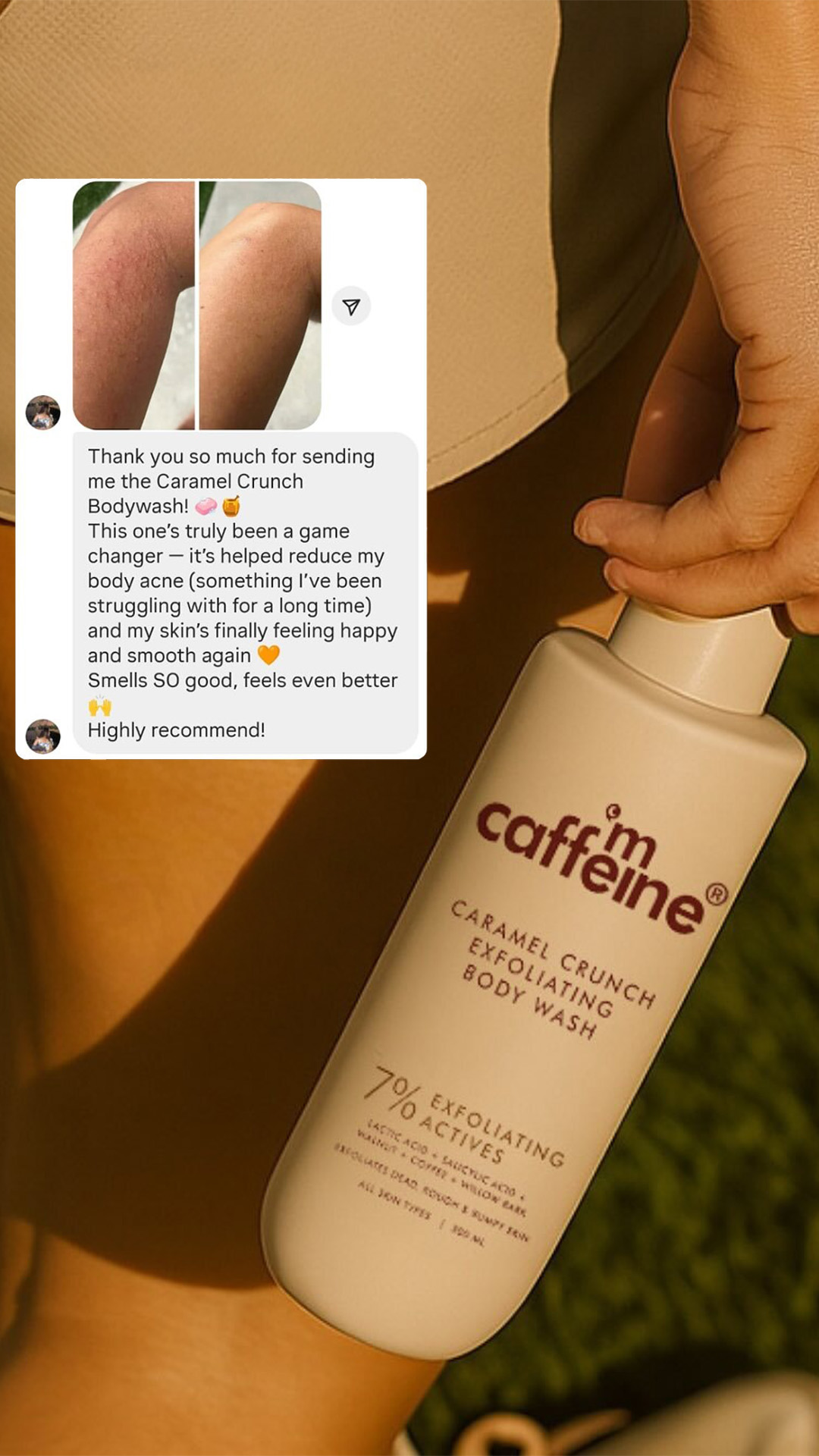 Strawberry Skin Gone in 28 Days!
NEW Caramel Crunch Body Wash

1% Salicylic Acid & 2% Lactic Acid:
✨Exfoliates & Removes Dead Skin
✨Targets Body Acne 
✨Reduces Bumpy & Strawberry Skin
✨Sweet Caramel Scent

Flat 20% Off |