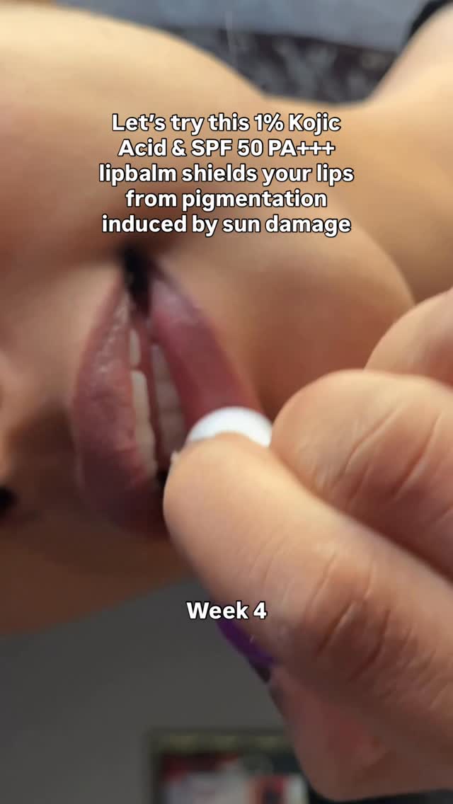 Comment 'LIPS' for link💖

#lips #pinklips #explorepage #fyp #trending #skincareroutine #glowingskin #viralreels #collab #instagram #pigmentation #bright #glow #skin #love #pharma #dermaplaning