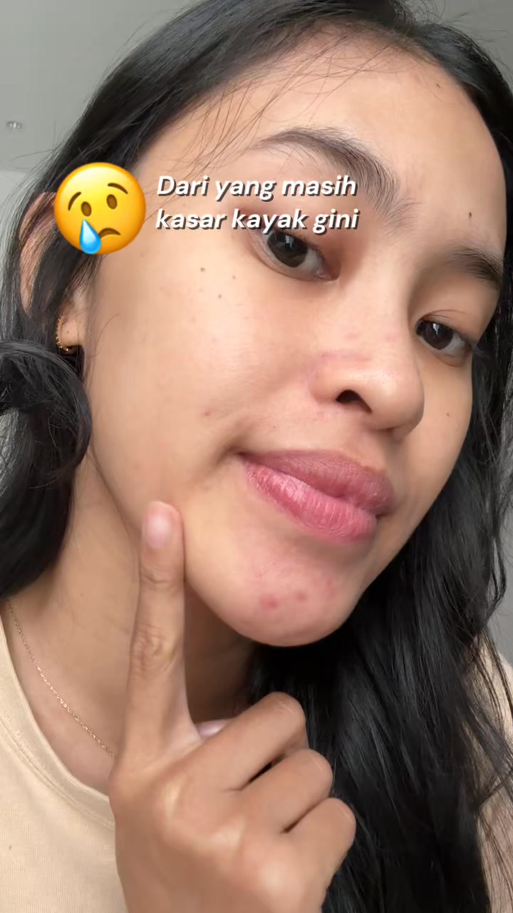 Kulit Mulus Glowing Pakai Lactic Acid! 🥰