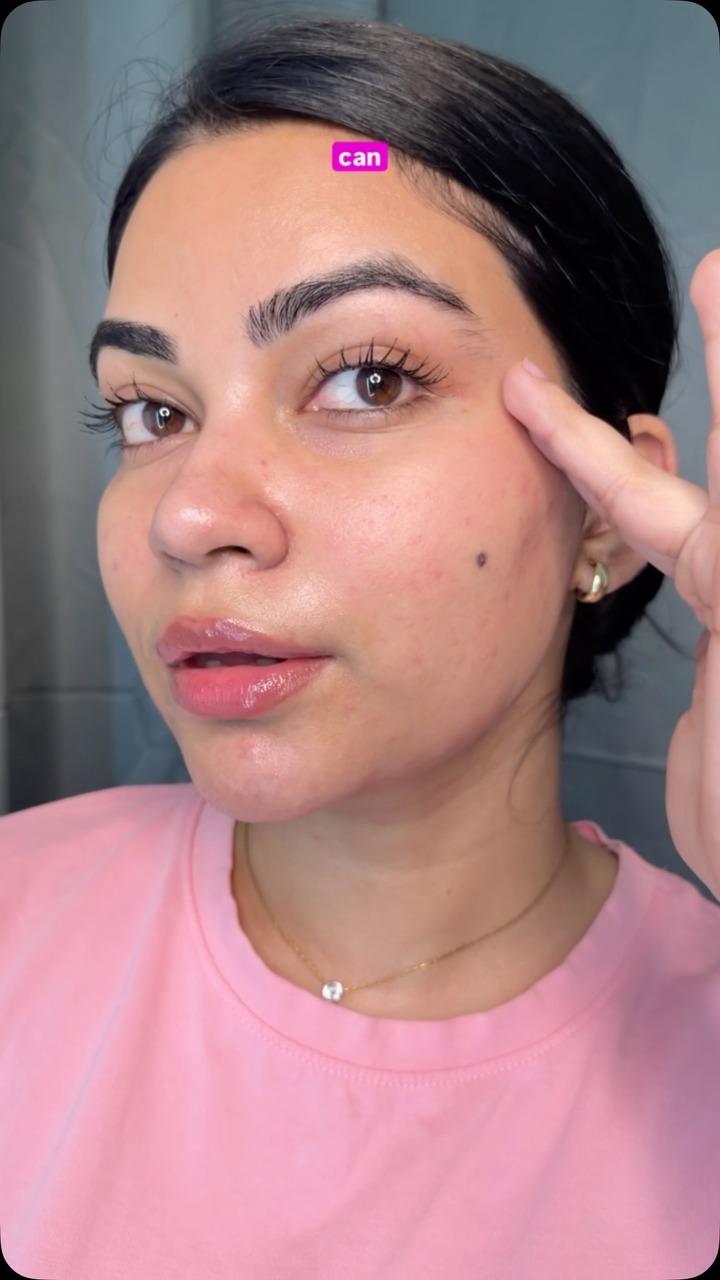 Serum that tackles entire acne life cycle✨

[ glowing skin, non sticky serum, lightweight serum, glowing skin serum, peptides, healthy skin, glass skin glow] 

#foxtale #foxtaleskin #glowingskin #healthyskin #foxtaleseru