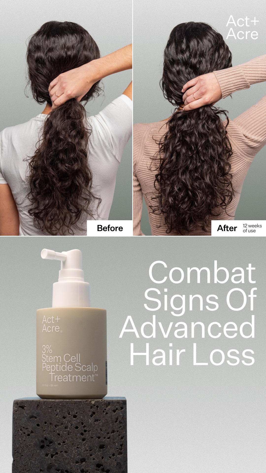 5 Reasons Why 86% Saw New Hair Growth