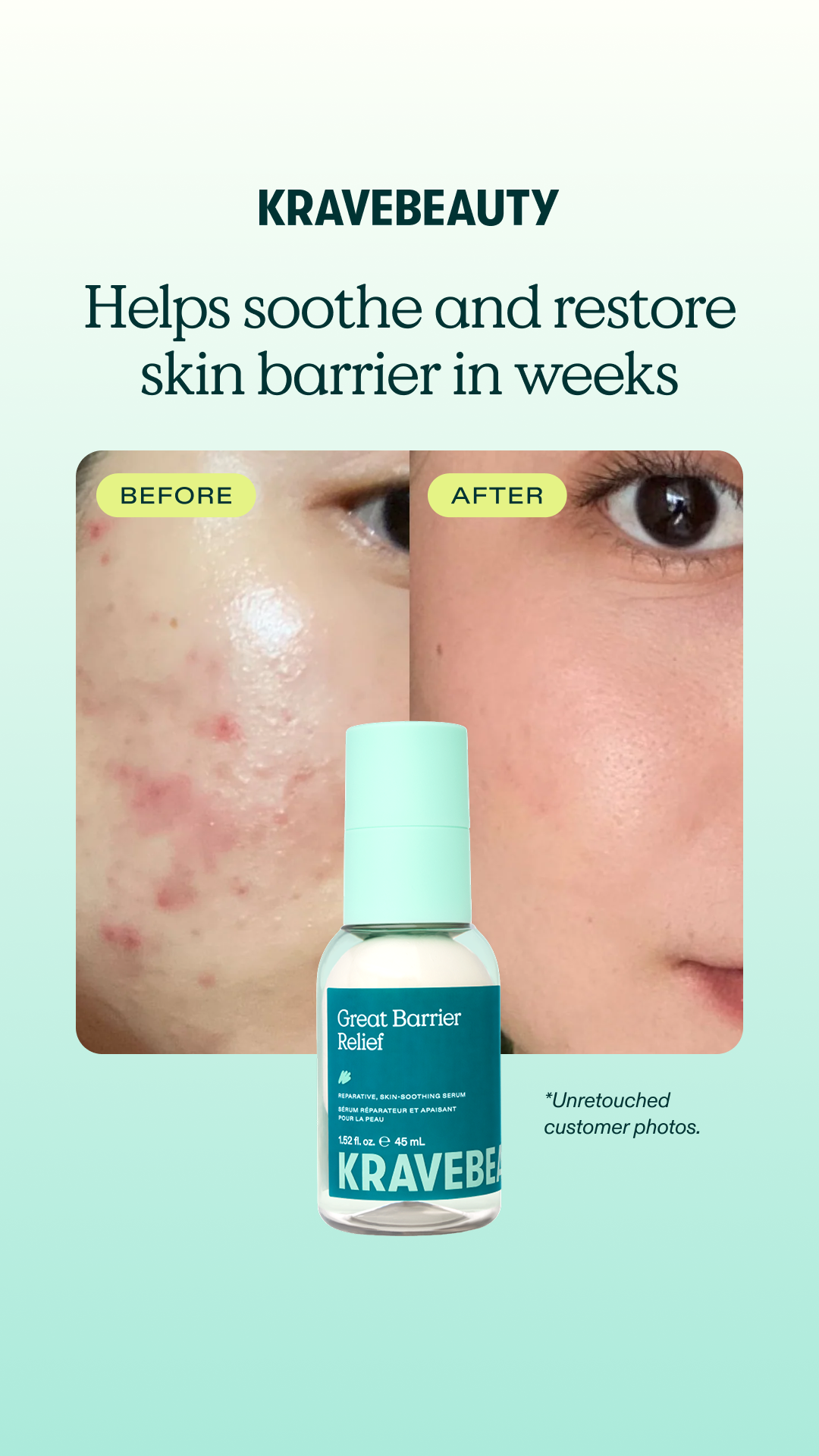 The Viral Tamanu Oil Serum