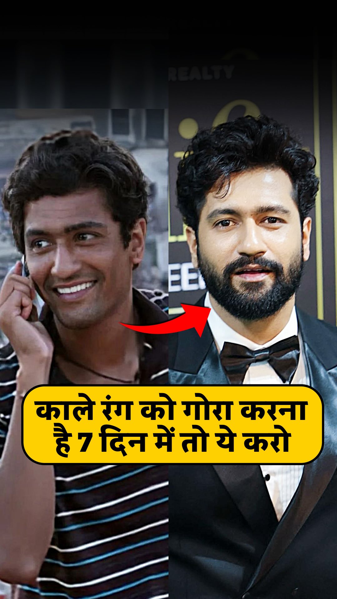Comment “ nahi chahiye “ to get link !

Agar kale chehre ko gora karna hai to skin me melanin production ko kam karna pdega yahi kaam aata hai Kojic acid jo aapke skin me melanin production ko kam karta hai and skin ko k