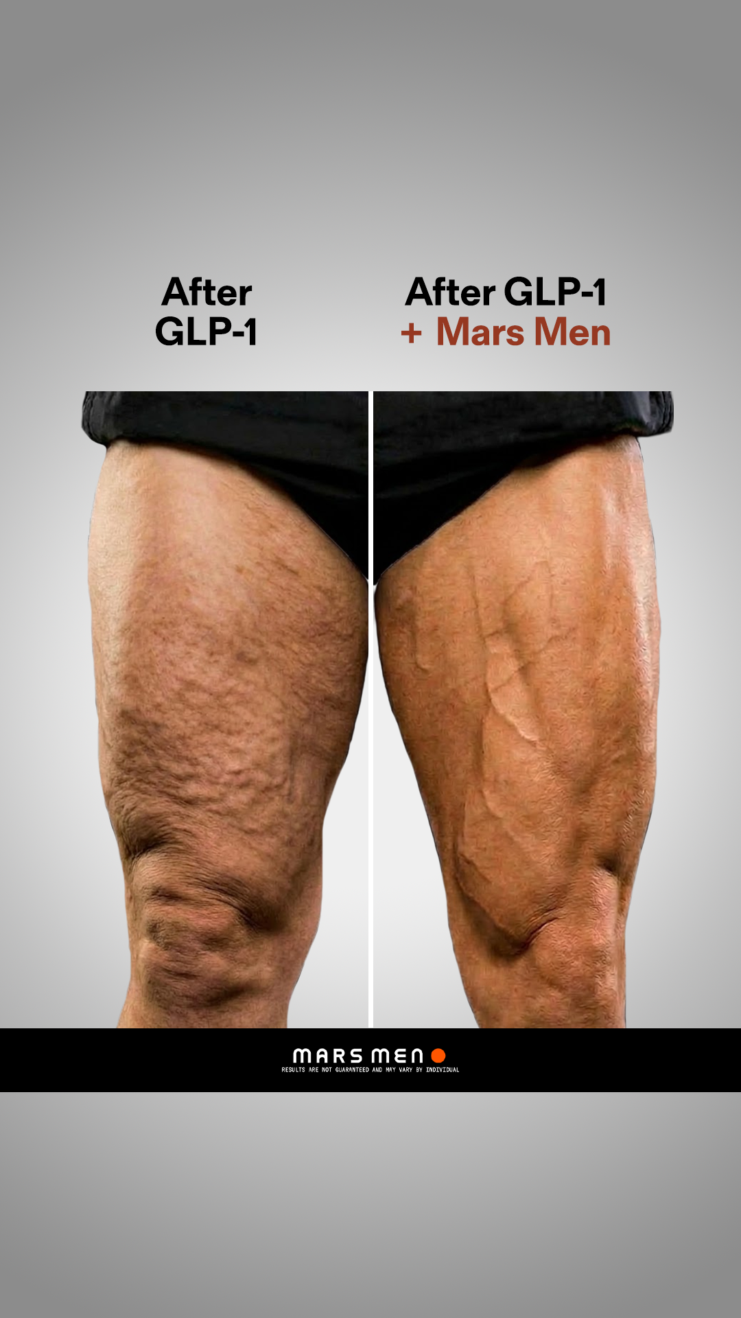 What GLP-1 Does to Your T Levels