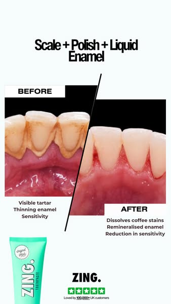 my top tip for getting rid of tea and coffee stains