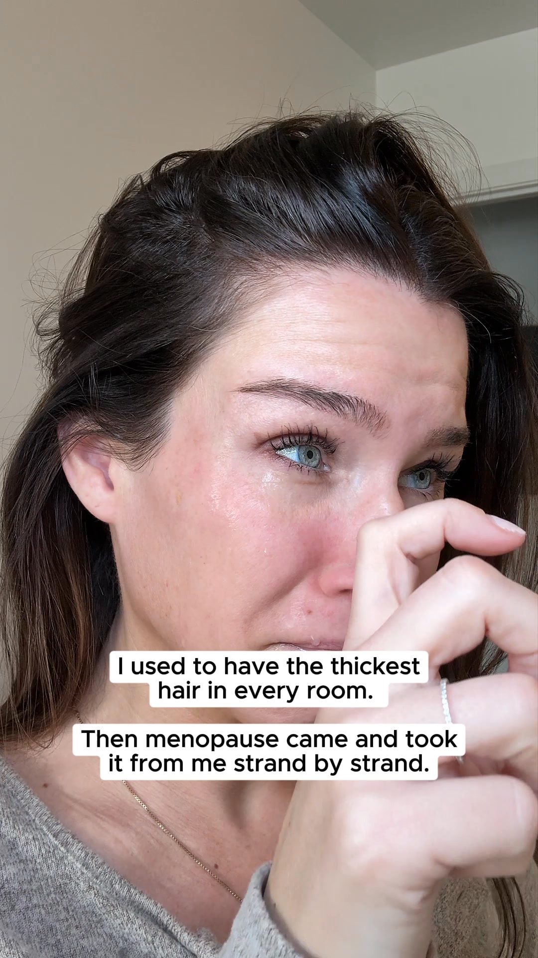 Help Hair Loss Naturally