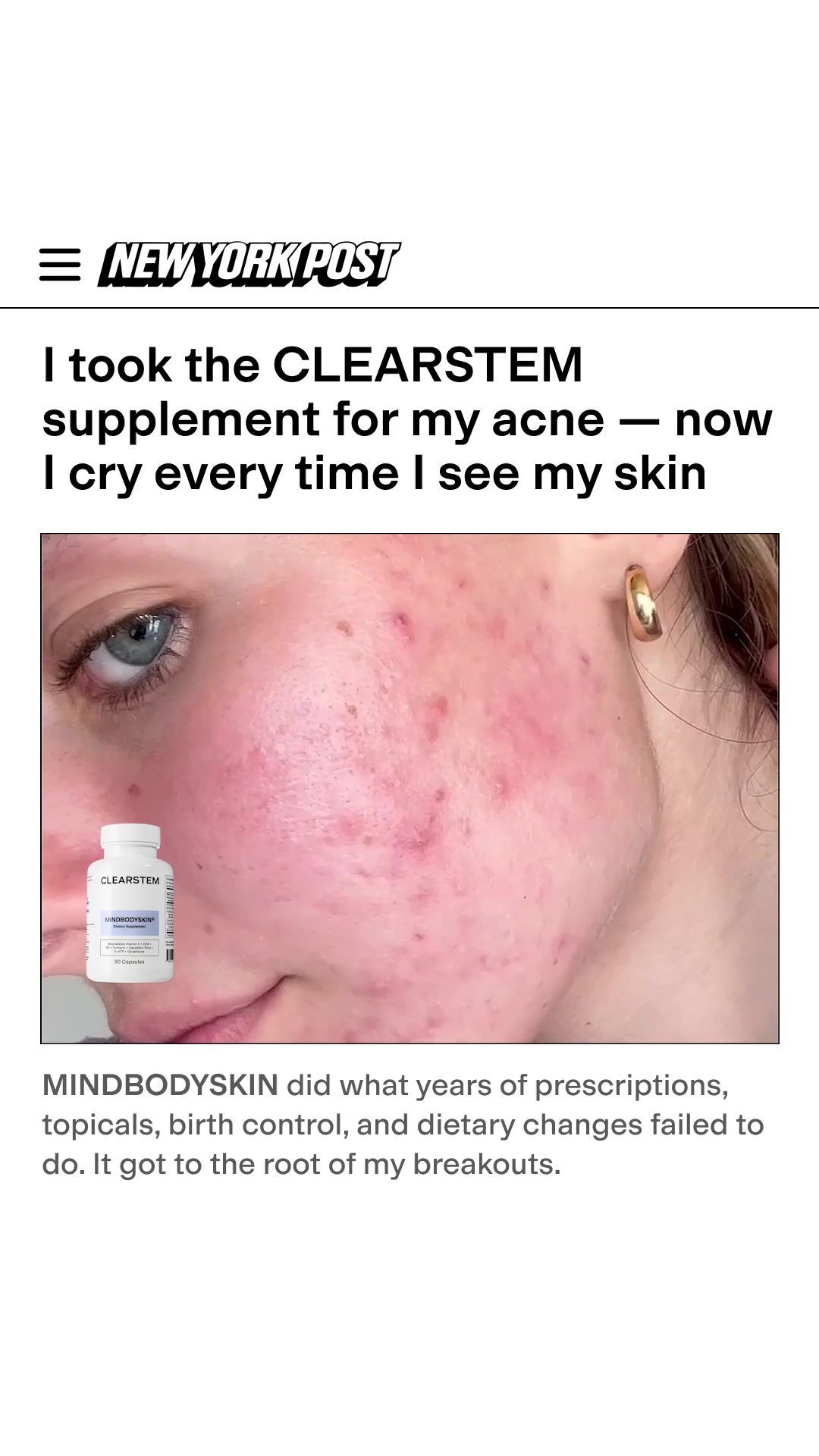 Get to the ROOT of Your Breakouts with CLEARSTEM