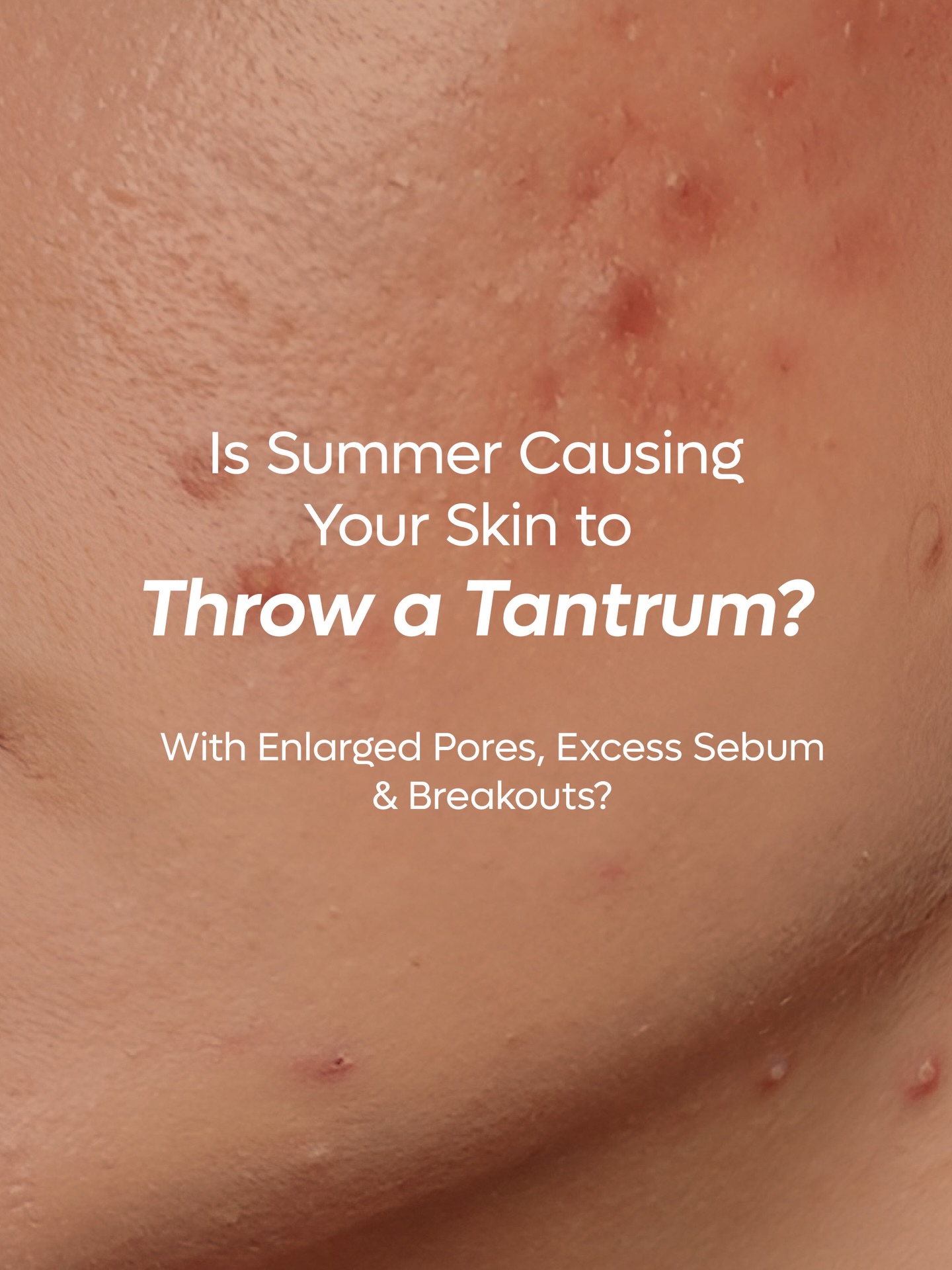 Wow Skin Science India