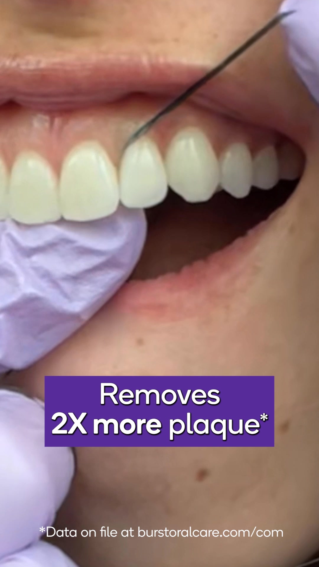 Expanding tech that does the hard work for you! 💪🦷✨

Say less🤌 Burst Expanding Floss is viral for a reason. Removes 2x more plaque than regular unwaxed dental floss*