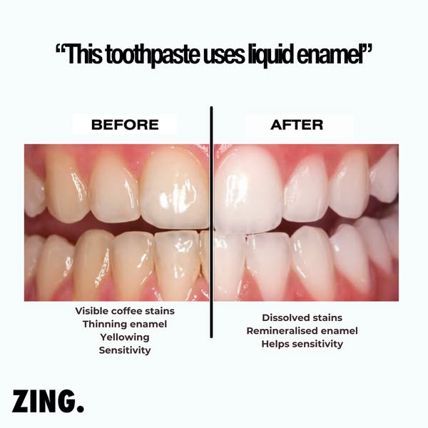 This toothpaste uses liquid enamel