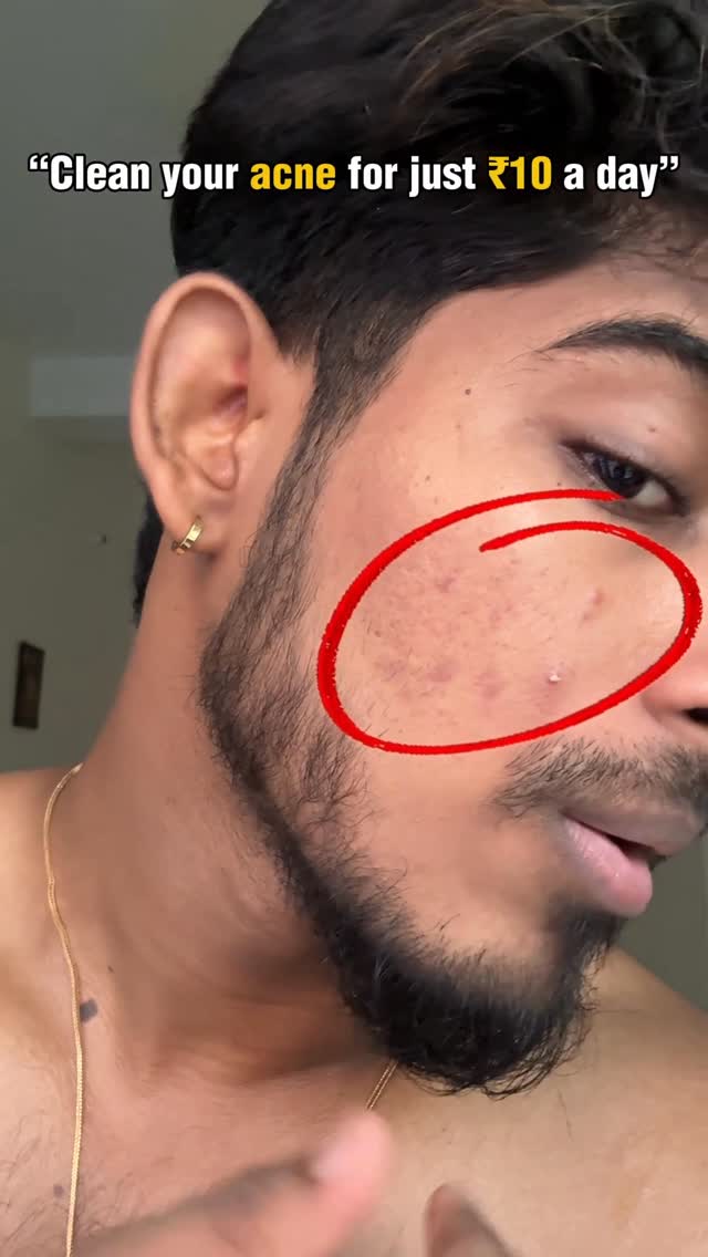 Best facewash to remove acne 🧴 Comment “Acne” to get link 🔗 
.
.
.
.
.
The Derma Co 2% Benzoyl Peroxide Facewash 🔗 
.
.
.
#thushal #thushalzfashion #dermaco #thedermaco #benzoylperoxide facewash