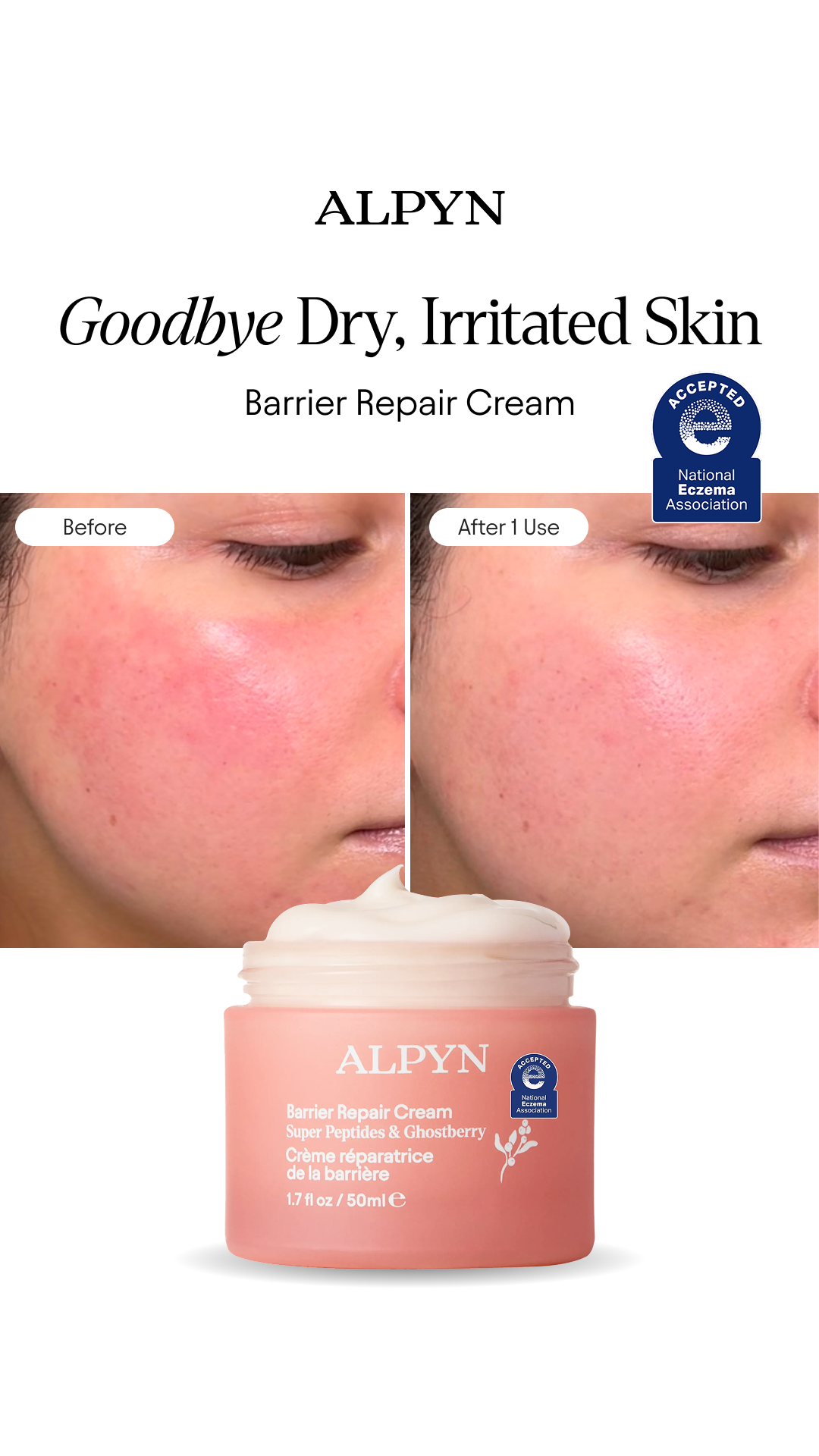 Goodbye Dry, Irritated Skin