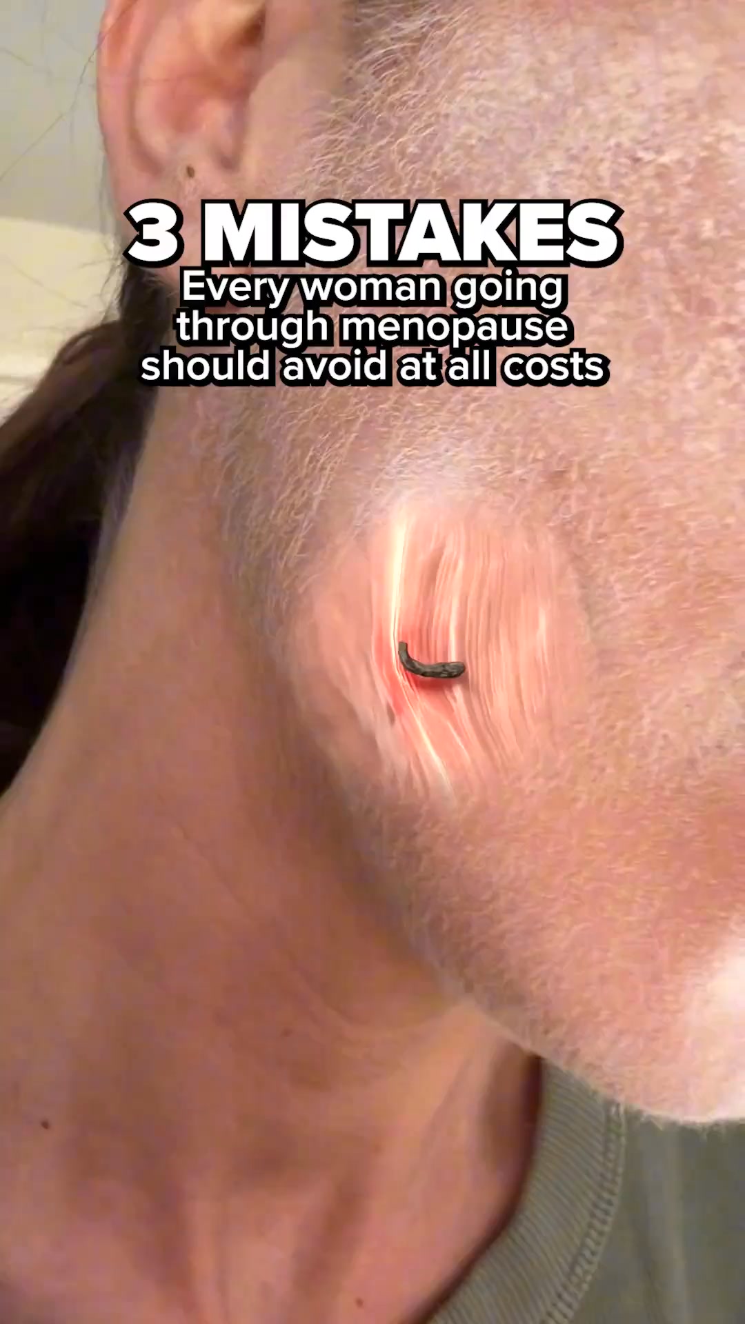 Easy At-Home Dermaplaning